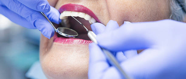 Best Dentist for Tooth Abscess  in Kotlik, AK